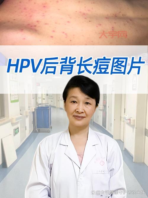 北京病例怎么感染的?传播链条清晰解读!