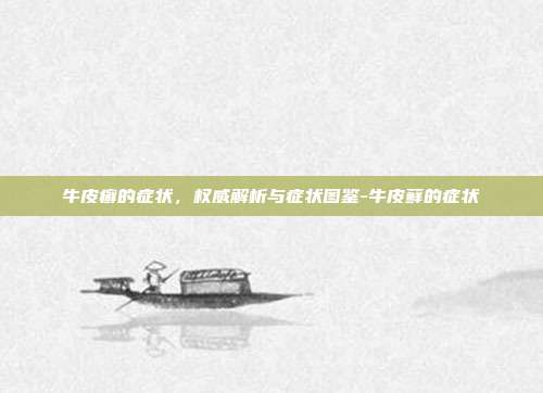 牛皮癣的症状,权威解析与症状图鉴-牛皮藓的症状